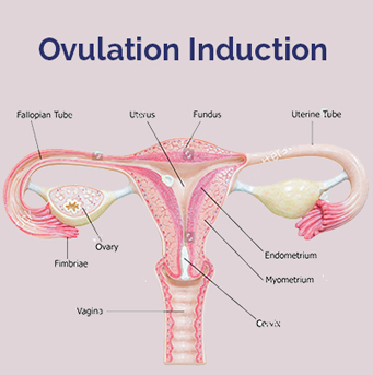 info-image